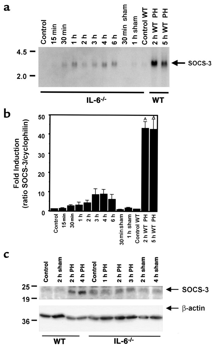 Blunted induction of SOCS-3 mRNA and protein in IL-6 KO mice after PH. T...