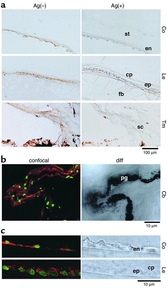 Immunolocalization of NBC-1 in the eyes. (a) Peroxidase-antiperoxidase s...