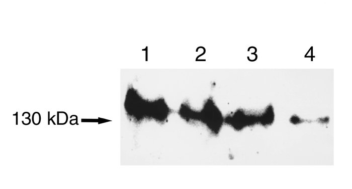 Effects of RZ-NBC on the expression of NBC-1 protein in HLE cells estima...