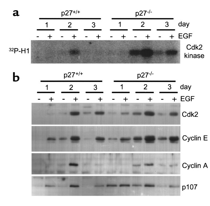 Cdk2-kinase activity and expression of late G1/S-phase cell cycle regula...
