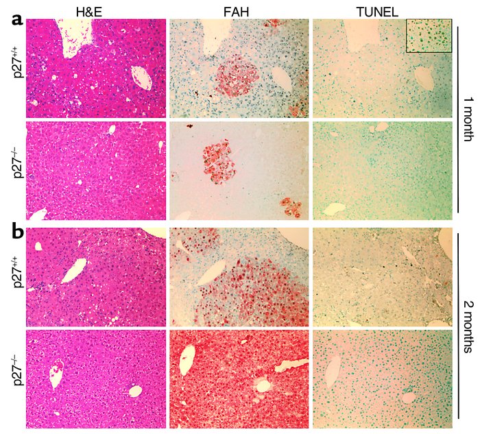 Immunohistochemical analysis of host livers after transplantation. Liver...