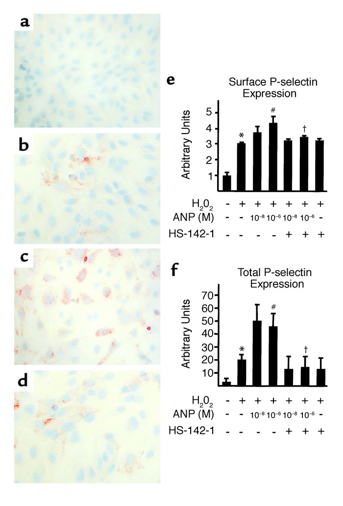 (a–d) Immunolabeling of P-selectin in HUVECs. (a) Unstimulated cells. (b...