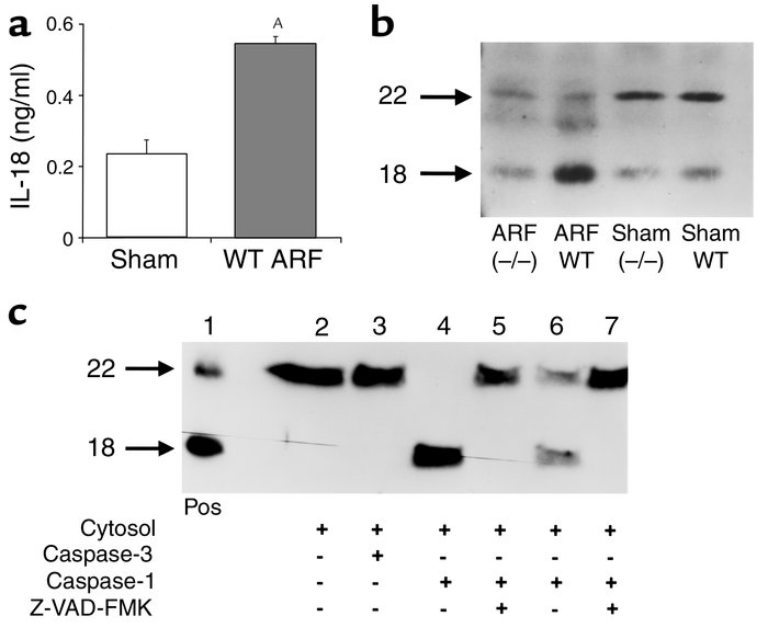 IL-18 in ischemic ARF. (a) IL-18 protein, measured by the ECL assay, was...