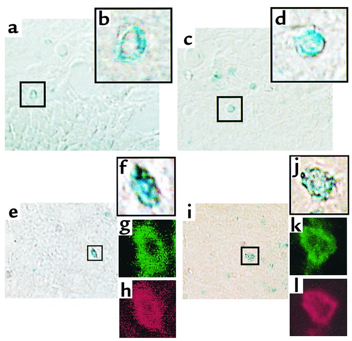 Incorporation of SP cells into vascular endothelial cells. (a–d) X-gal–s...