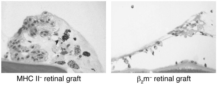 Histology of MHC class II and MHC class I KO (β2m KO) allogeneic (B6) re...