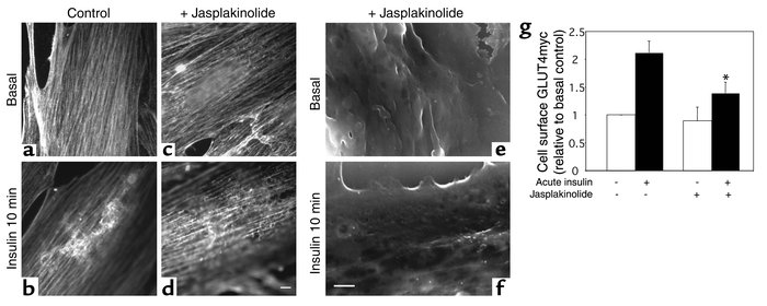 Jasplakinolide disrupts actin filament turnover and reduces insulin-indu...