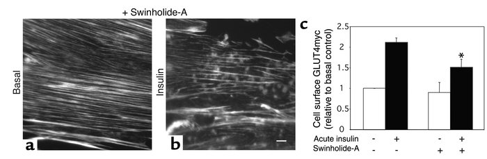 Swinholide-A selectively blocks actin remodeling and partially reduces i...