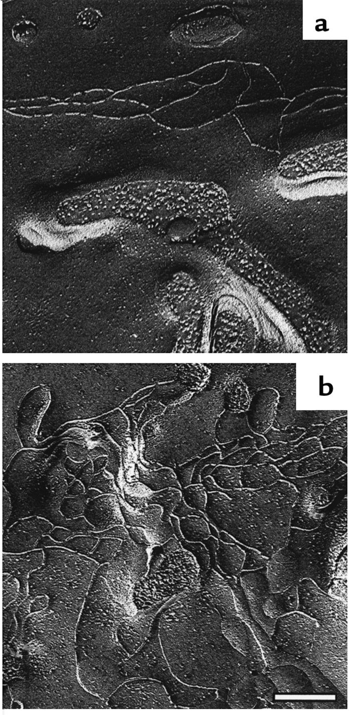Freeze-fracture analysis of claudin-4–overexpressing MDCK cells. Uninduc...