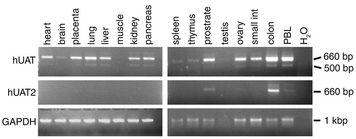 Comparison of PCR products amplified from CLONTECH Laboratories Inc. MTC...