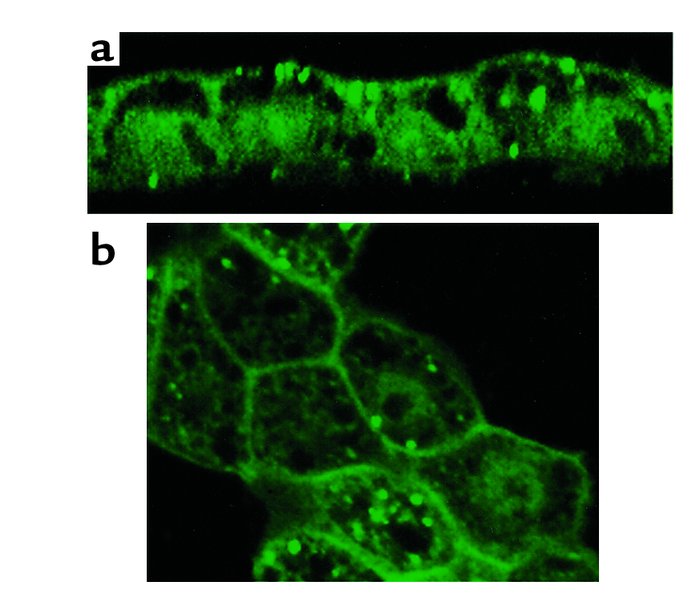 Confocal microscopy of stably transfected LLC-PK1 cells expressing EGFP ...
