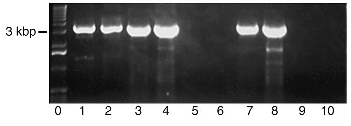 PCR of human genomic DNA (lanes 1, 2) and BAC clones 452D14 (lanes 3–6) ...