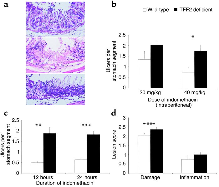 Increased indomethacin-induced gastric ulcers in TFF2-deficient mice. (a...