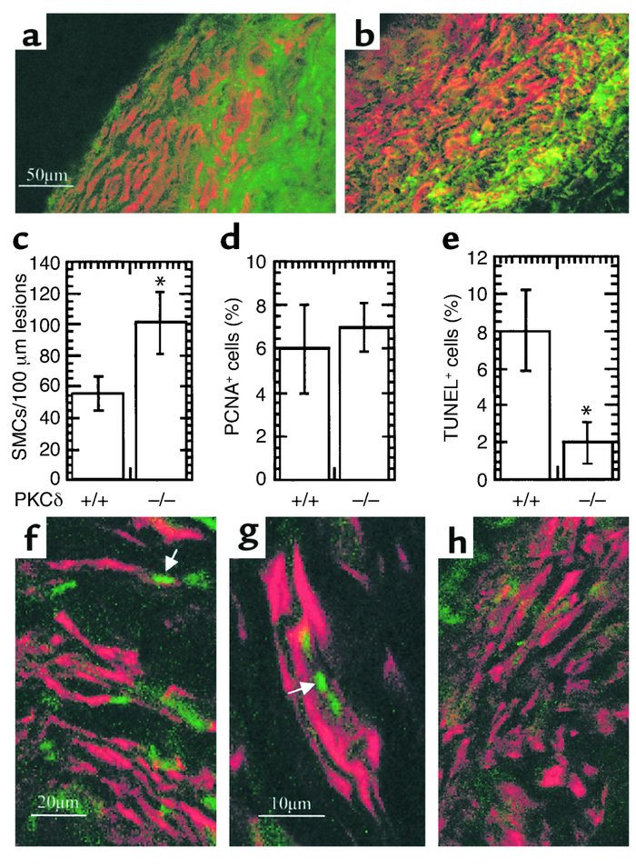 Immunofluorescence double labeling of vein graft sections (a and b). Cry...