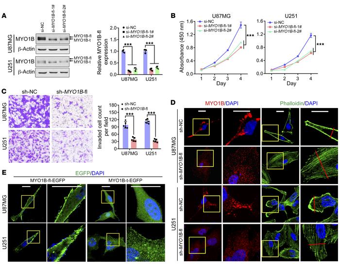 MYO1B-fl promotes GBM malignancy, and MYO1B isoforms differ in subcellul...