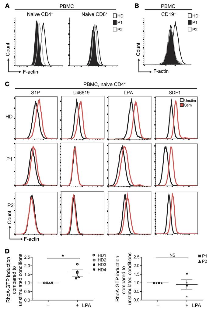 Reduced polymerized actin in lymphocytes is a signature of ARHGEF1 defic...