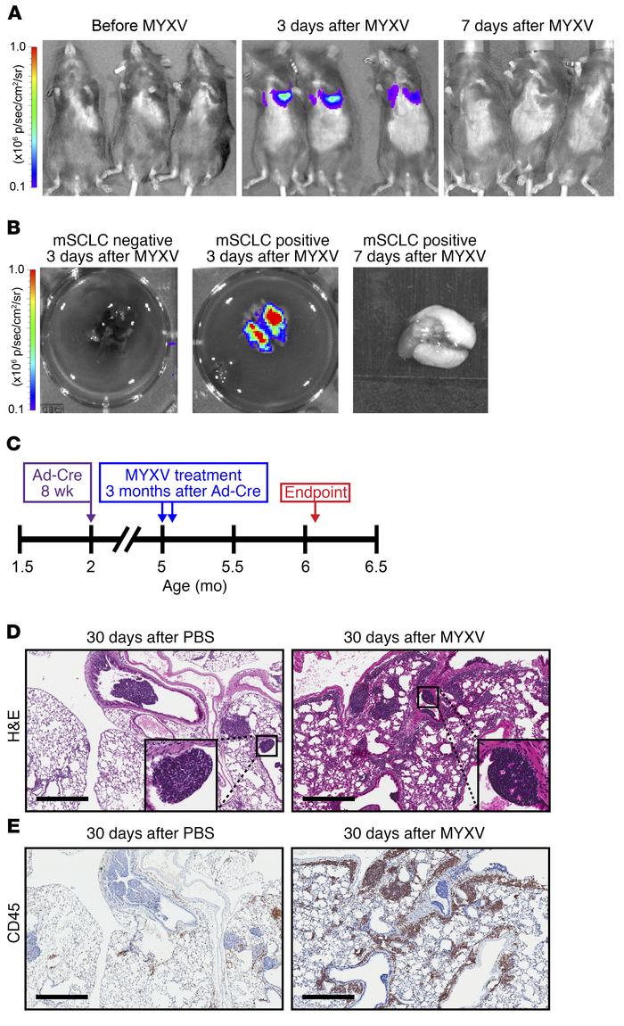 MYXV localizes to the lungs of tumor bearing mice resulting in a prolong...