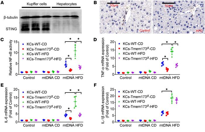 mtDNA from hepatocytes of HFD-fed mice induced activation of NF-κB and i...