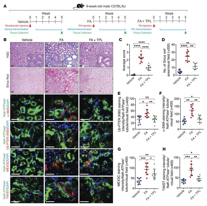 Triptolide reduces FA-induced kidney fibrosis.
(A) Scheme of the experim...