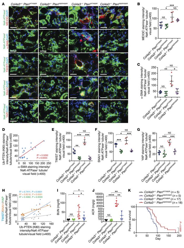 Pten K80R mutant reduces EMT during renal fibrosis.
(A) Representative i...