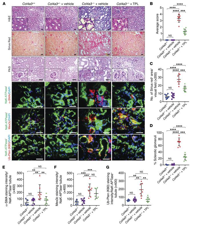 Triptolide alleviates kidney fibrosis.
(A) Representative images of H&am...