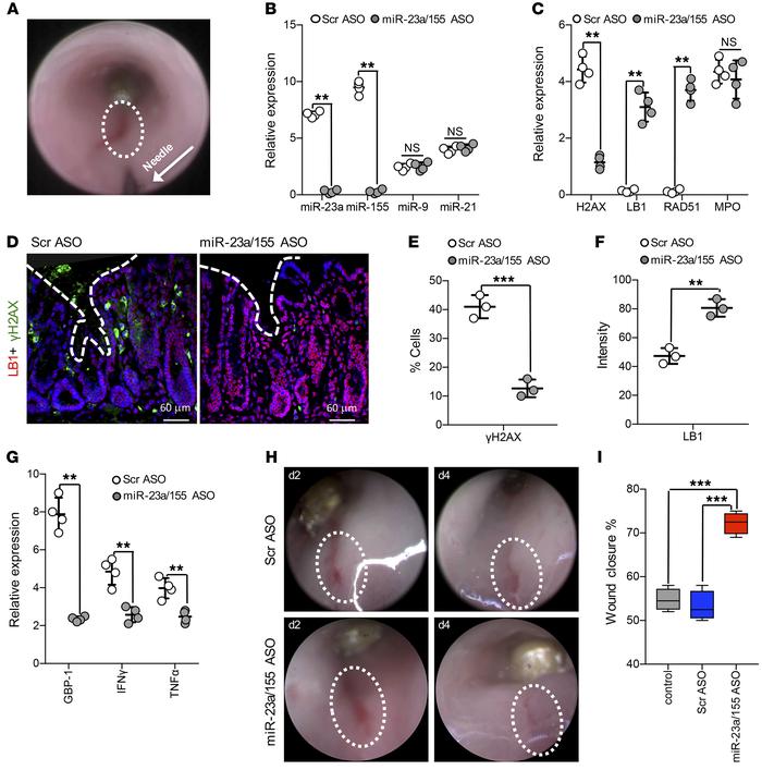 Inhibition of miR-23a and miR-155 promotes DSB repair and improves mucos...