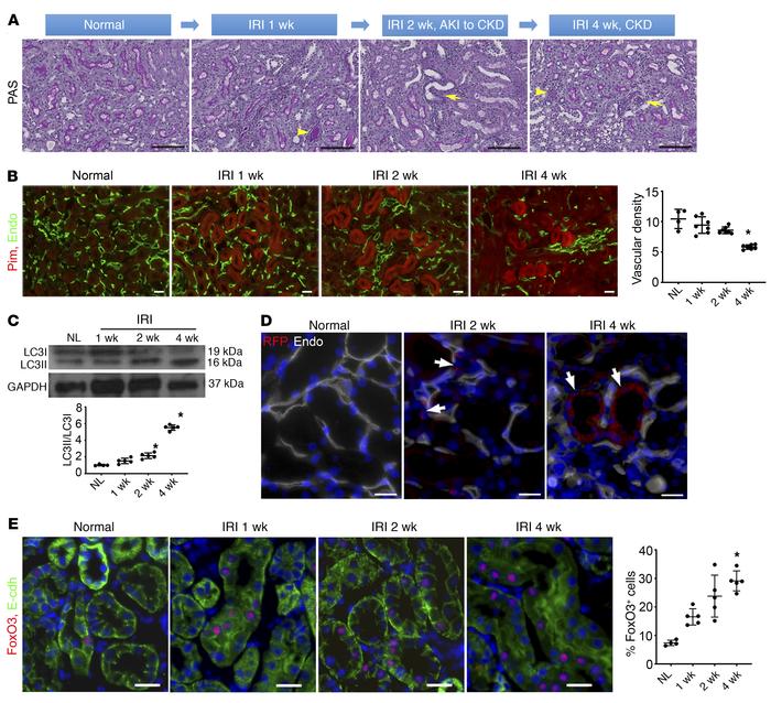 Severe renal IRI leads to CKD, hypoxia, and activation of autophagy and ...