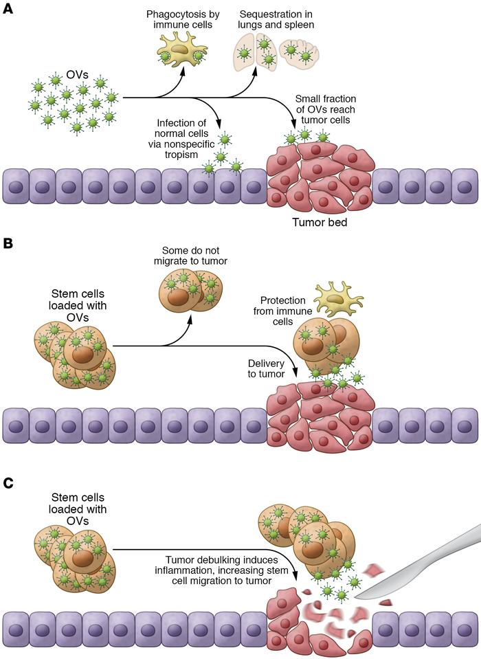 Optimizing OV delivery with SCs.
(A) Intrinsic immunotherapy of OVs. OVs...