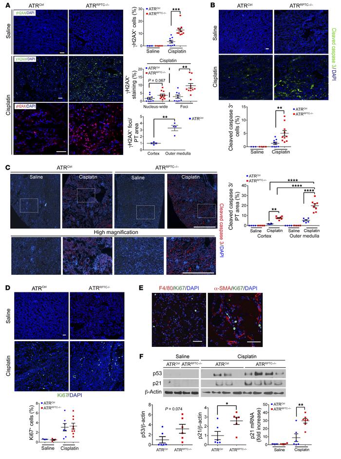ATRRPTC–/– mice have enhanced DNA damage and apoptosis after cisplatin i...