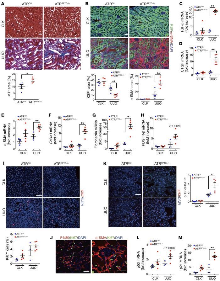 The increase in fibrosis and G2/M phase cell cycle is greater in ATRRPTC...