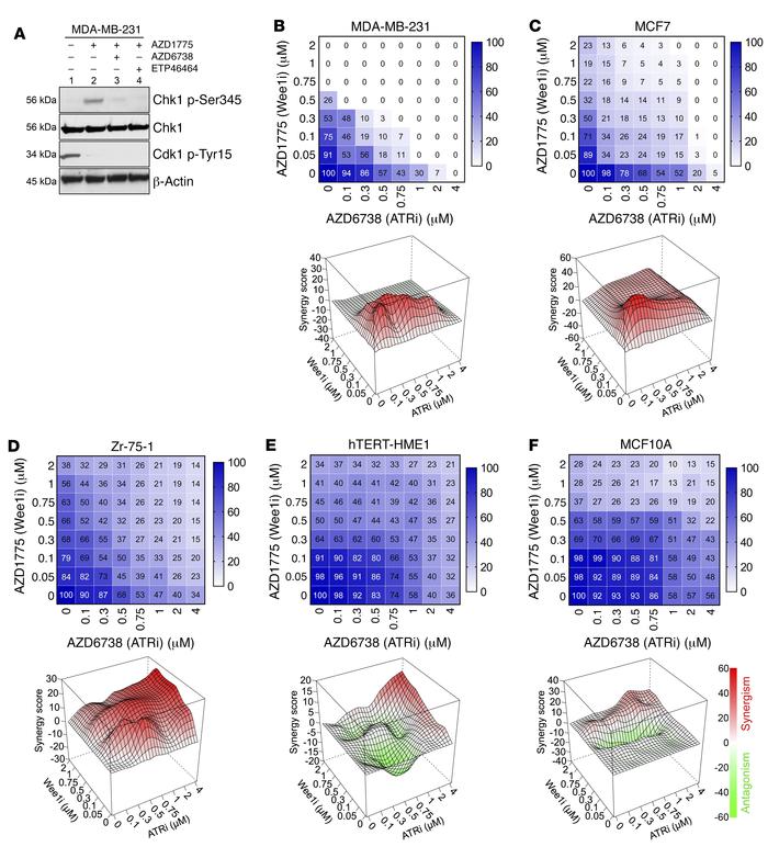 Wee1 inhibition activates ATR and shows synergistic cancer cell killing ...