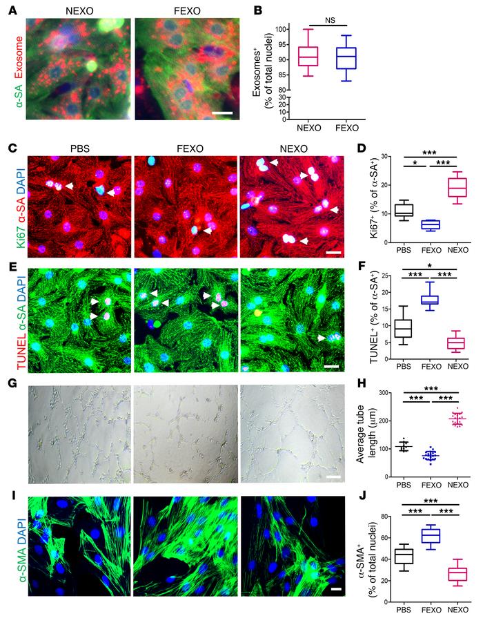 Effects of exosome treatment on cardiomyocytes, endothelial cells, and c...