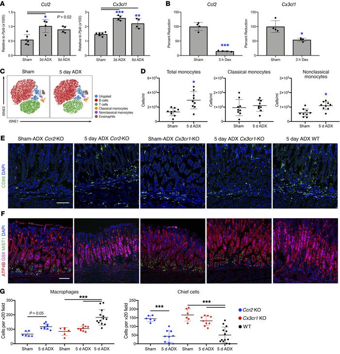 Infiltrating monocytes drive the development of gastric metaplasia.
Quan...