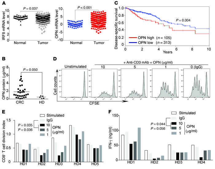 OPN is elevated in human colon carcinoma and inversely correlated with p...