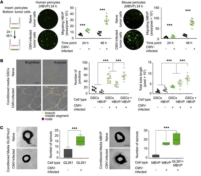 Conditioned medium from CMV-infected GBM cells increases pericyte migrat...