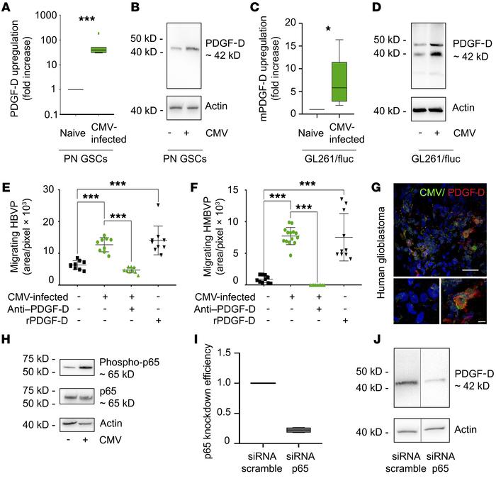 PDGF-D upregulation by CMV in GBM.
(A) qRT-PCR for PDGF-D in GSCs after ...