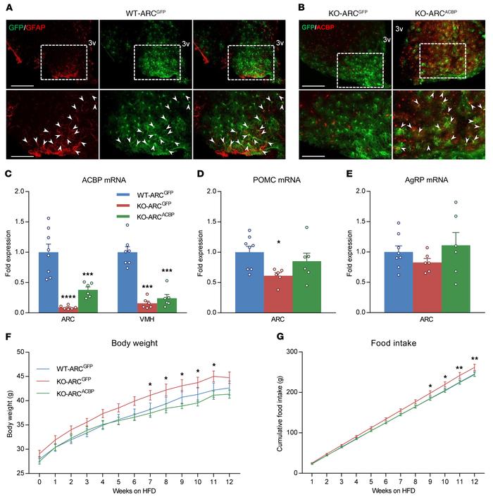 Genetic rescue of ACBP in GFAP+ astrocytes of the ARC prevents diet-indu...