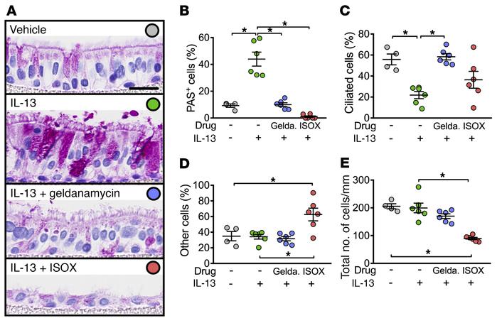 HSP90 inhibition prevents IL-13–induced goblet cell metaplasia in human ...