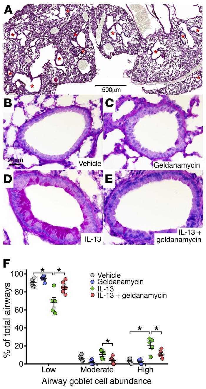 HSP90 inhibition prevents IL-13–induced airway goblet cell metaplasia in...