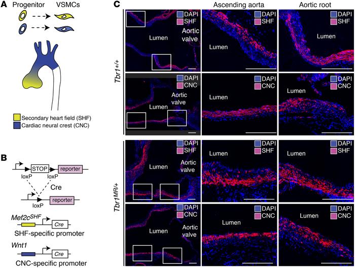 SHF- and CNC-derived VSMCs intermingle in the aortic root of Tbr1MR/+ mi...