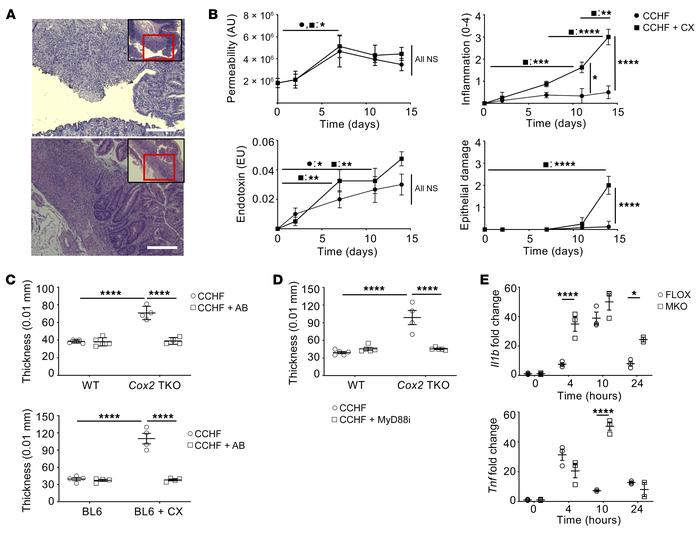 Dysregulated response to TLR-dependent signaling drives intestinal infla...