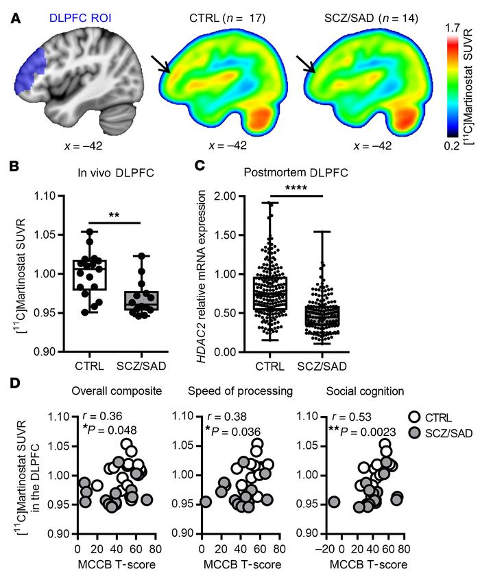 [11C]Martinostat SUVR in the DLPFC is lower in subjects with SCZ/SAD com...