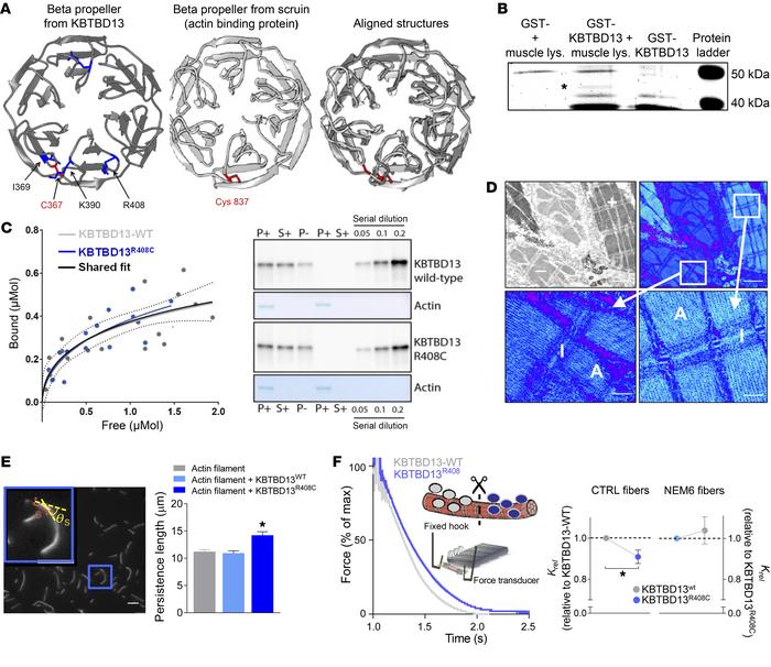 Effect of KBTBD13 on sarcomere structure and function.
(A) Homology mode...