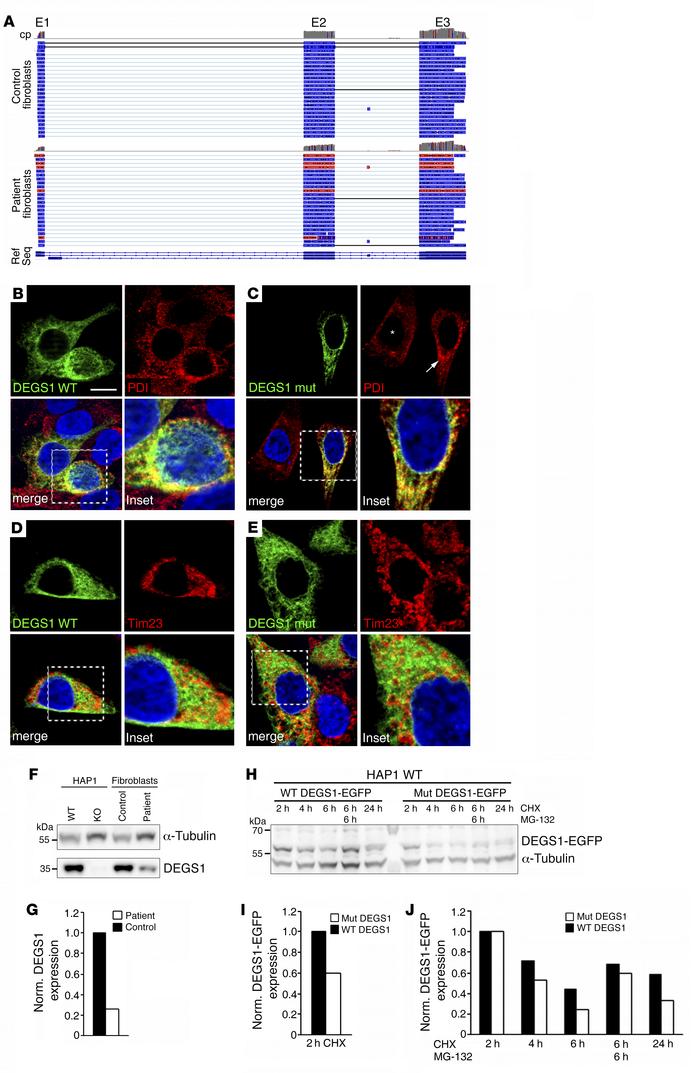 Characterization of mutant DEGS1 protein.
The DEGS1 p.Ala280Val mutation...