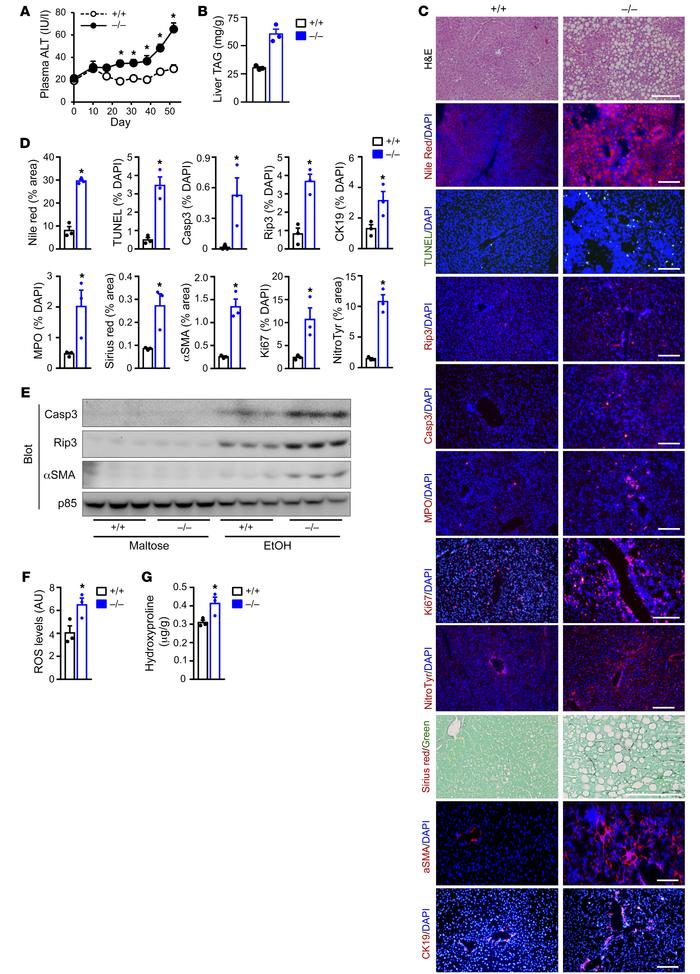 Ucp1 deficiency exacerbates ALD in males.
Ucp1+/+ and Ucp1–/– males were...