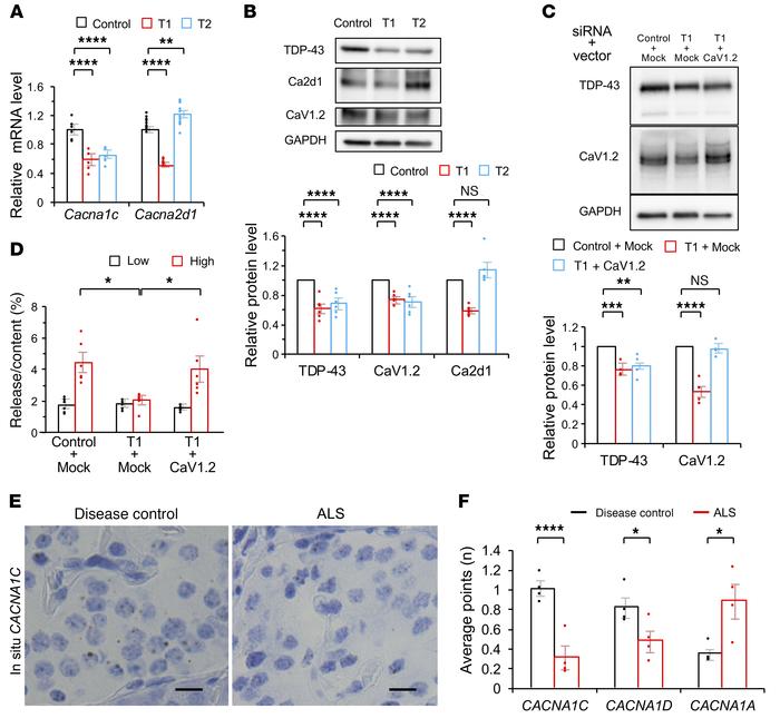 CaV1.2 downregulation mediates impairment of the first phase of insulin ...