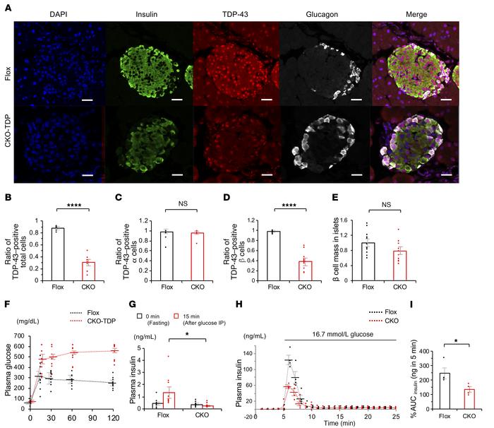 Insulin secretion is suppressed in Tardbp flox mouse mated with RIP-Cre ...