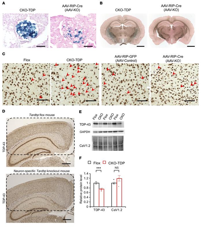 Brain expression driven by the RIP-Cre promoter in pancreatic-specific a...