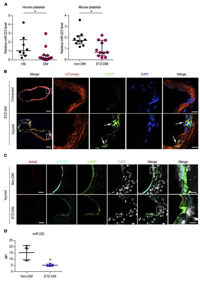 The miR-223 level was reduced in DM platelets and VSMCs in injured femor...