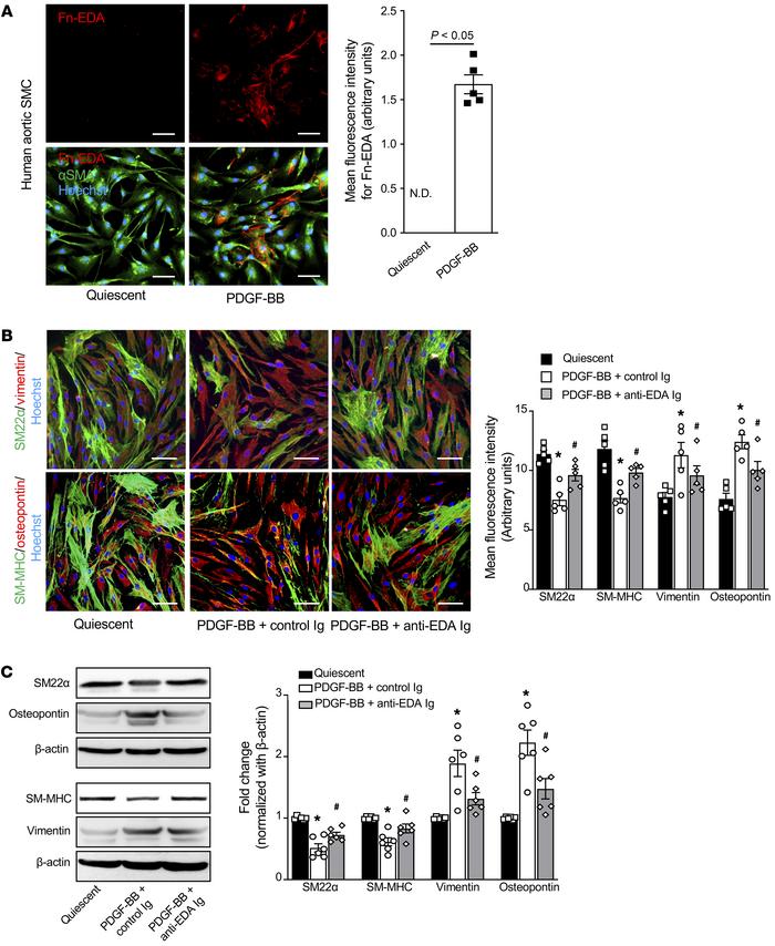 Targeting cFn with anti–Fn-EDA Ig suppresses synthetic phenotype and att...