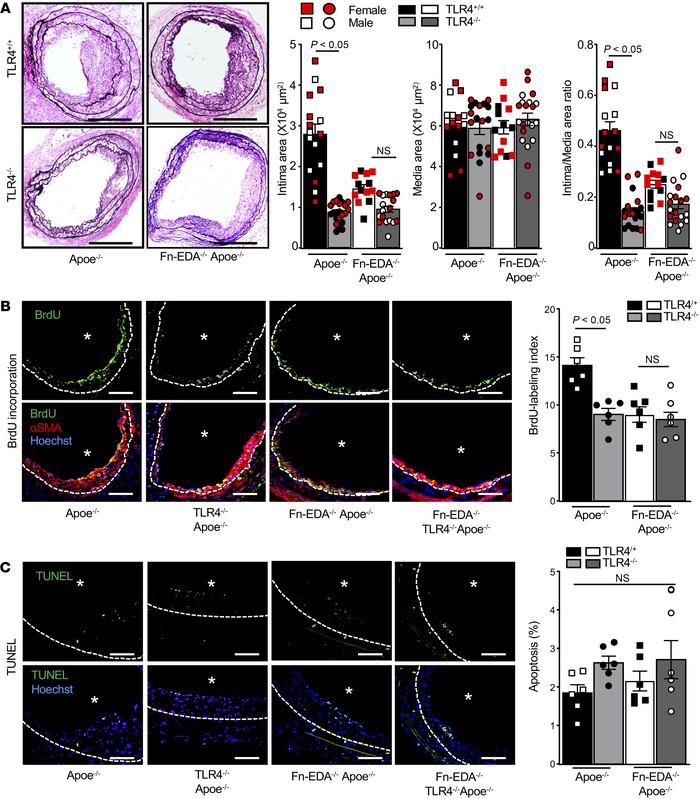 Fn-EDA promotes neointimal hyperplasia and SMC proliferation in vivo via...